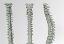 Czy nafta jest dobra na wypadanie włosów?